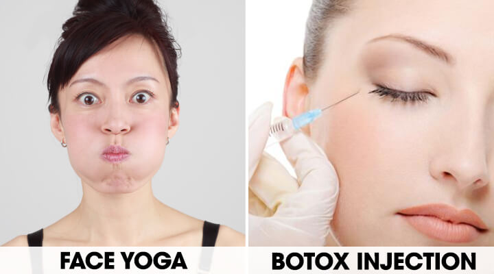 Photo showing a woman with black hair doing face yoga vs a photo of a woman injecting botox into her eye area.