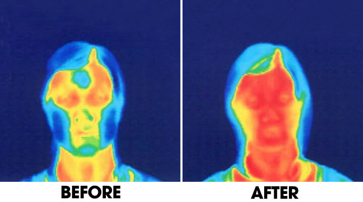 Before and After - Face Yoga Method thermographic presentation 