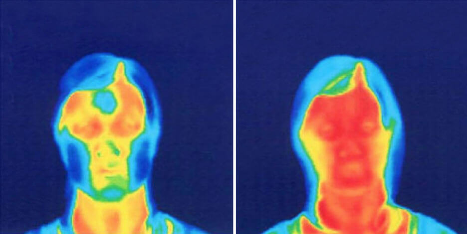 Face Yoga Method Thermographic image.