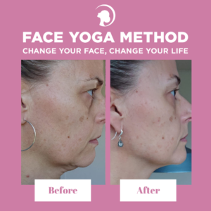Before and after of a Face Yoga practitioner - double chin removal with facial exercises.