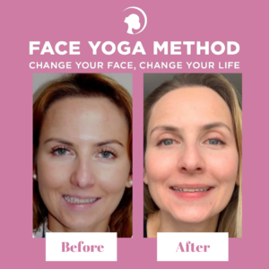 Before and after of a Face Yoga practitioner - fixed crooked smile with facial exercises.