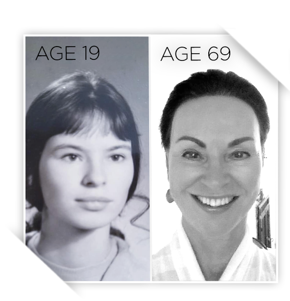 Two photos of a woman smiling - comparison at different age stages.