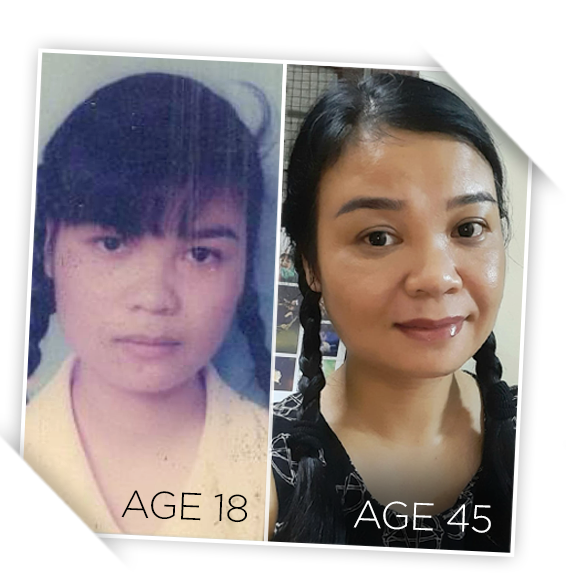 Two photos of a woman smiling - comparison at different age stages.