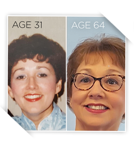 Two photos of a woman smiling - comparison at different age stages.