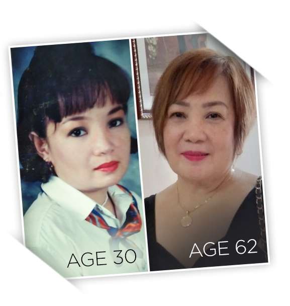 Two photos of a woman smiling - comparison at different age stages.
