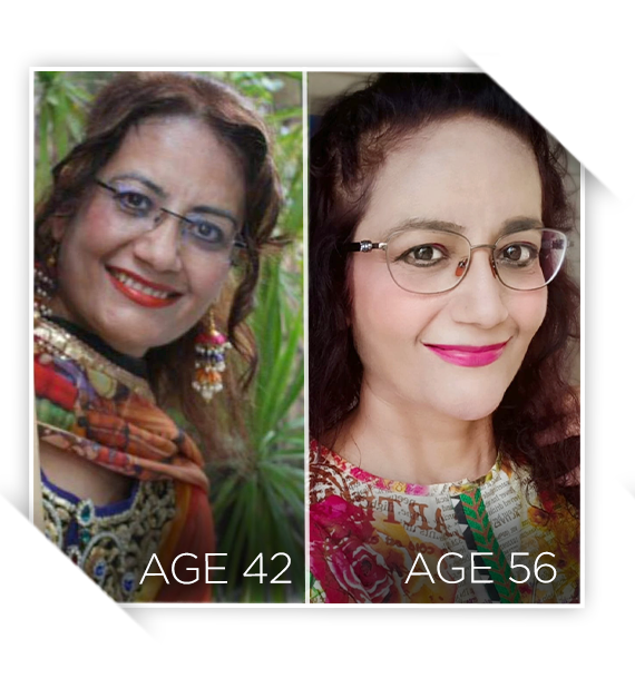 Two photos of a woman smiling - comparison at different age stages.