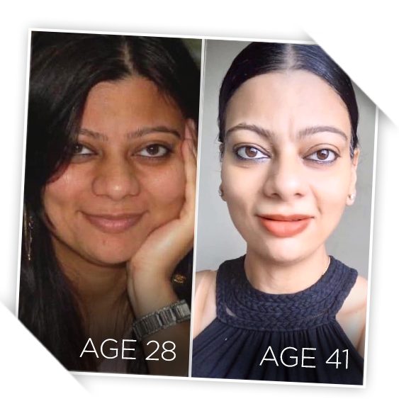 Two photos of a woman smiling - comparison at different age stages.
