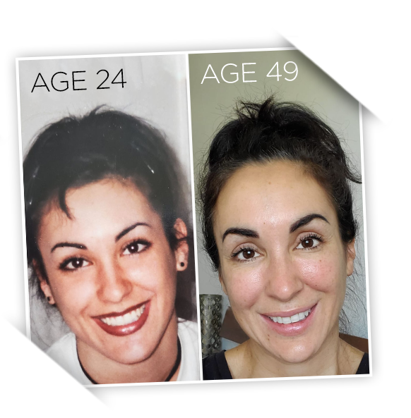 Two photos of a woman smiling - comparison at different age stages.