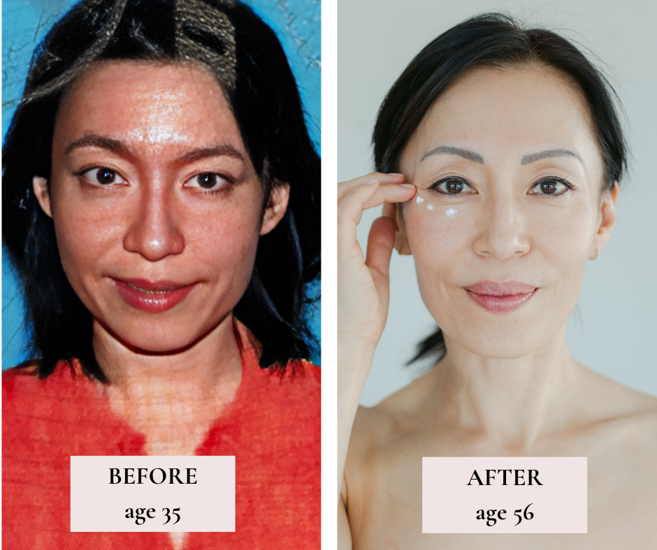 Before and after face yoga - comparison of Fumiko's face. 