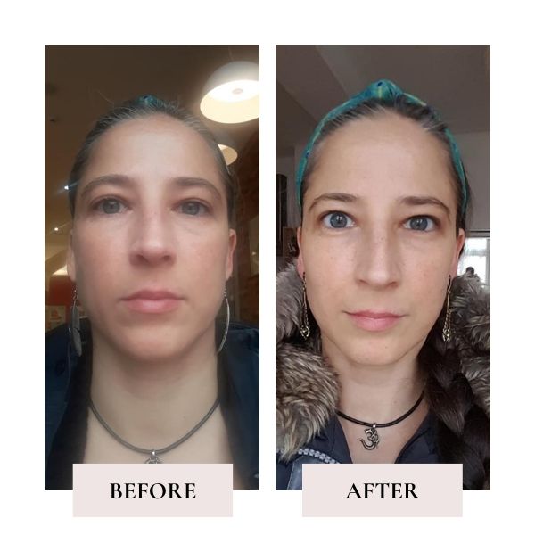 Before and after face yoga - comparison of Elena's face. 