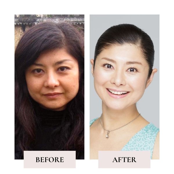 Before and after face yoga - comparison of Yoshiko's face. 