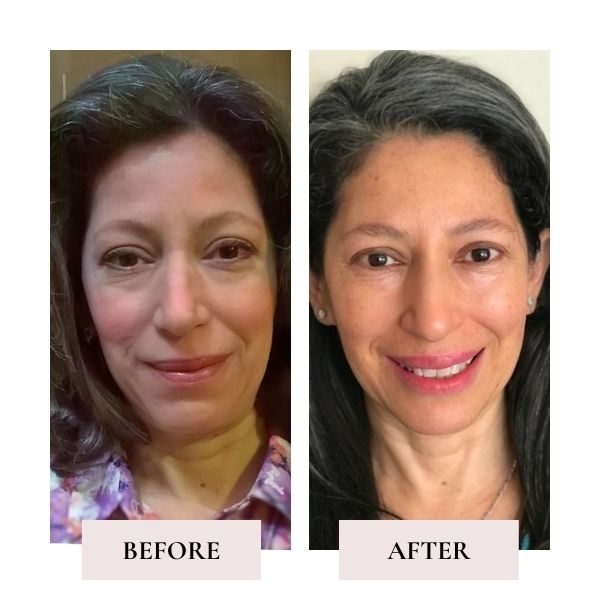 Before and after face yoga - comparison of Gloria's face. 