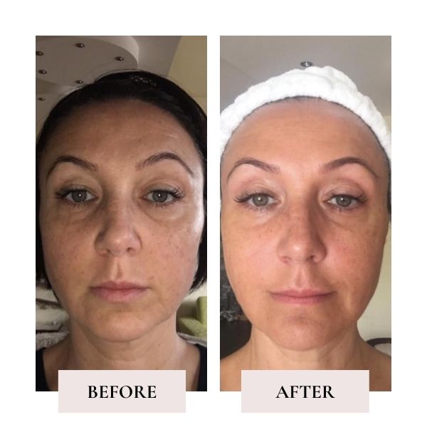 Before and after face yoga - comparison of Ivana's face. 