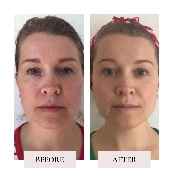 Before and after face yoga - comparison of Julia's face. 