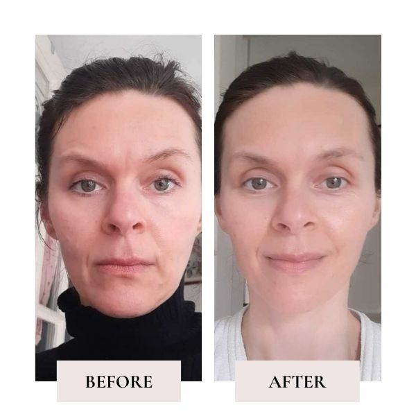 Before and after face yoga - comparison of Maja's face. 