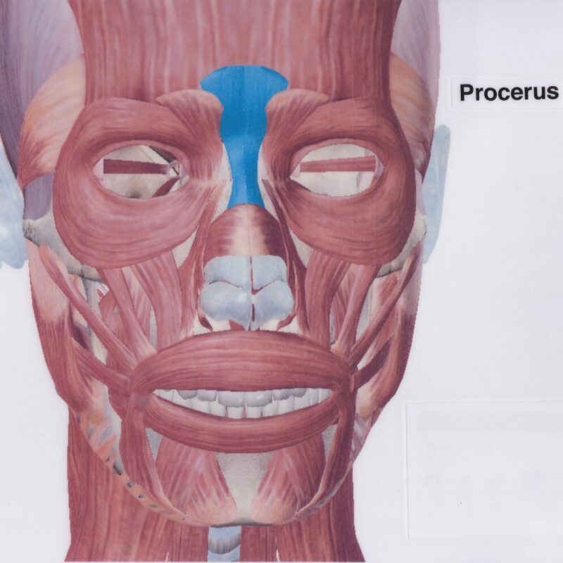 Human skull muscle anatomy - nasal muscle Procerus shown. 