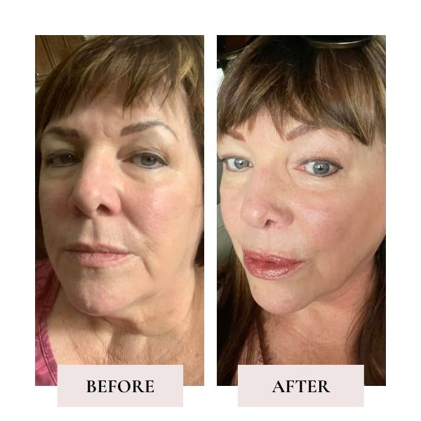"face yoga results long term — Face Yoga Method before and after