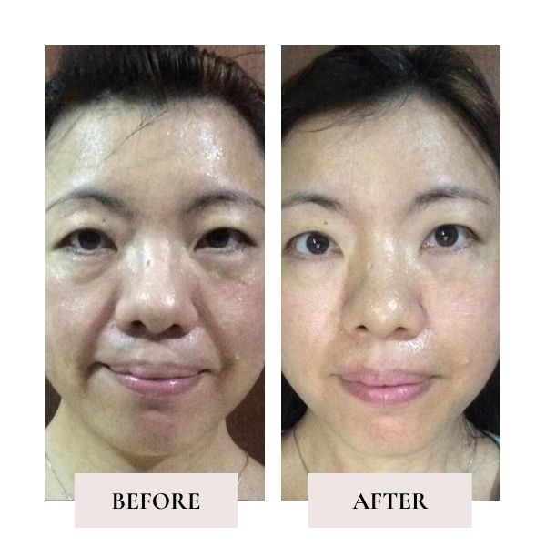 face yoga results six weeks — Face Yoga Method